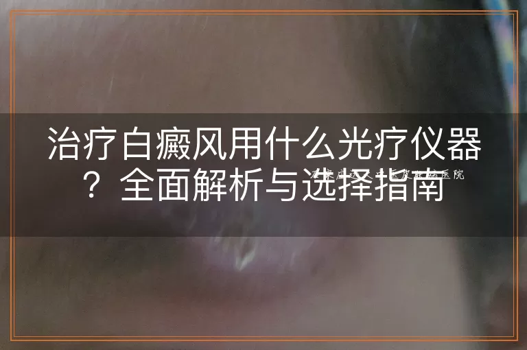 治疗白癜风用什么光疗仪器?全面解析与选择指南
