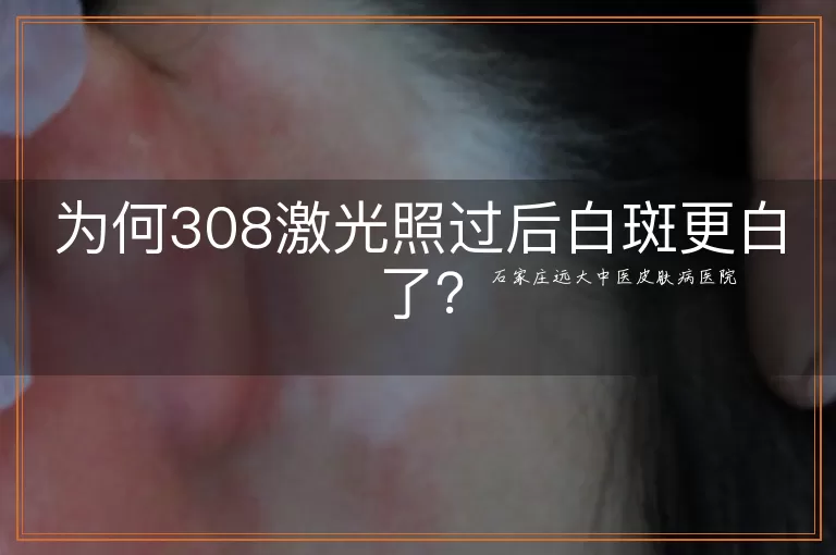 为何308激光照过后白斑更白了？