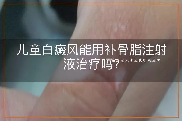 儿童白癜风能用补骨脂注射液治疗吗?