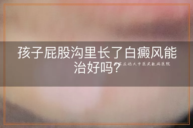 孩子屁股沟里长了白癜风能治好吗？