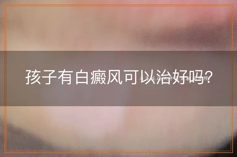 孩子有白癜风可以治好吗?