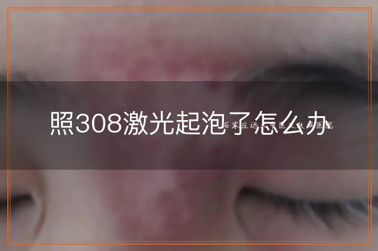 照308激光起泡了怎么办