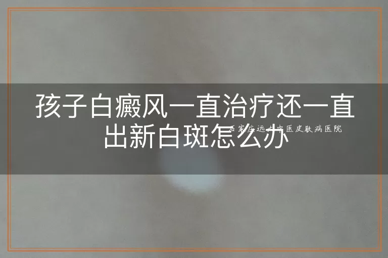孩子白癜风一直治疗还一直出新白斑怎么办
