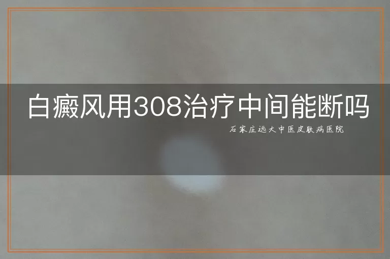 白癜风用308治疗中间能断吗