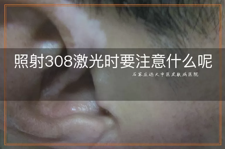 照射308激光时要注意什么呢