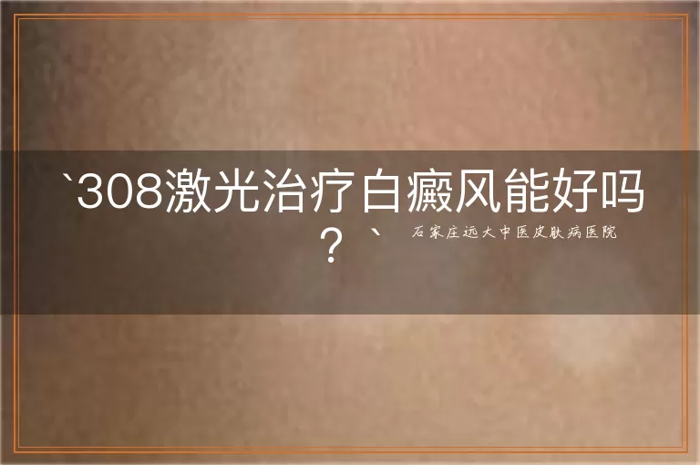 308激光治疗白癜风能好吗？