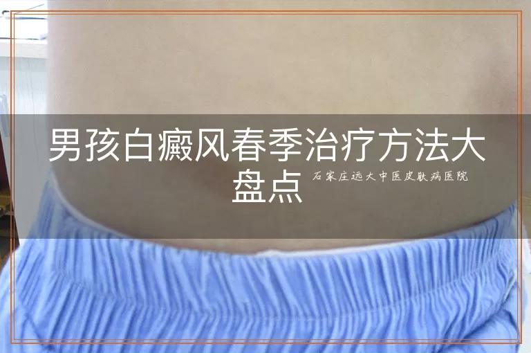 男孩白癜风春季治疗方法大盘点