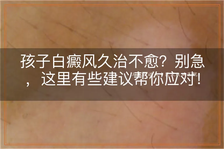 孩子白癜风久治不愈？别急，这里有些建议帮你应对！