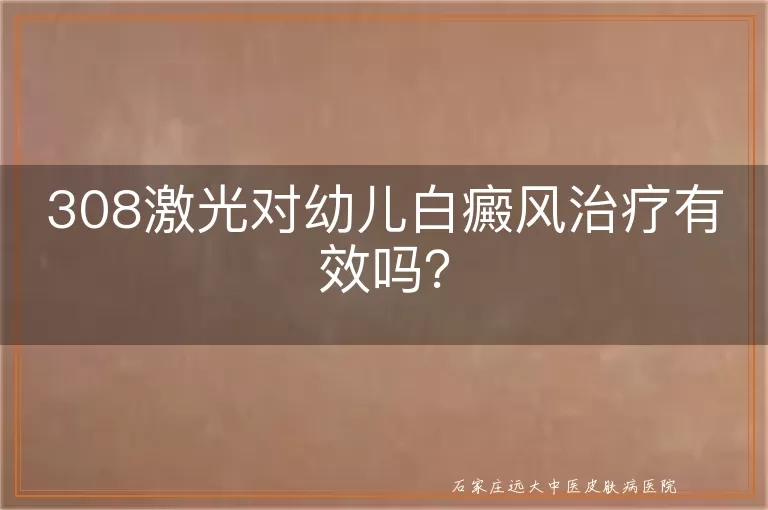 308激光对幼儿白癜风治疗有效吗？