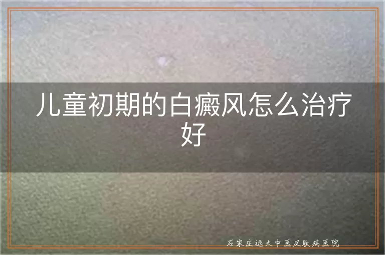 儿童初期的白癜风怎么治疗好