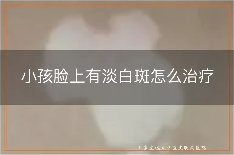 小孩脸上有淡白斑怎么治疗