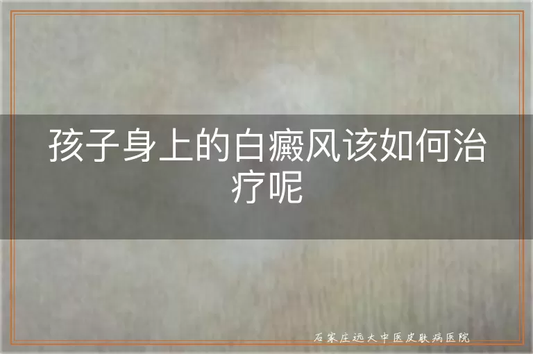 孩子身上的白癜风该如何治疗呢