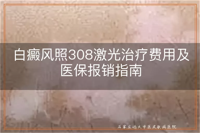 白癜风照308激光治疗费用及医保报销指南