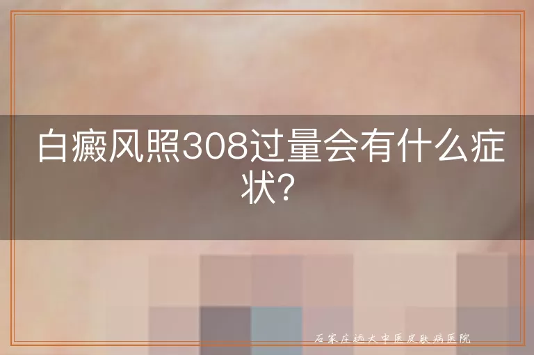 白癜风照308过量会有什么症状?