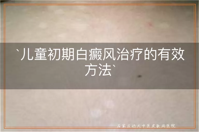 儿童初期白癜风治疗的有效方法