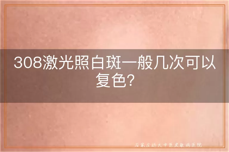 308激光照白斑一般几次可以复色？