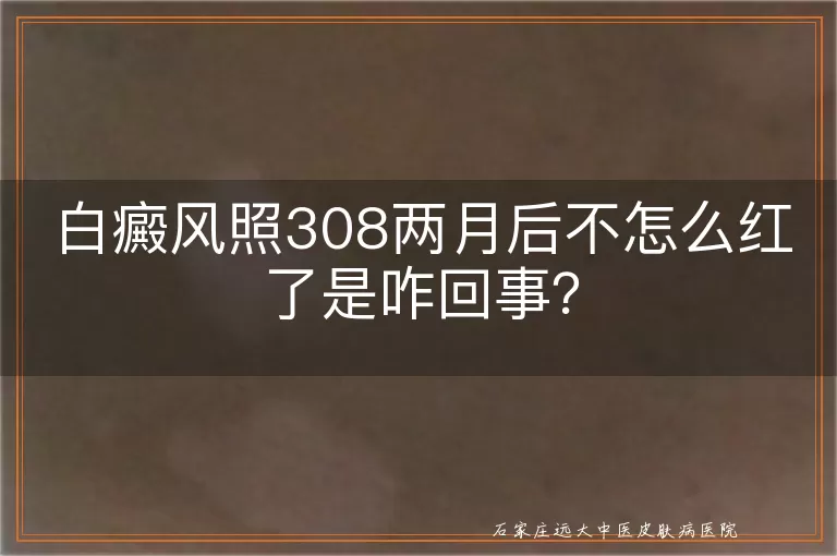 白癜风照308两月后不怎么红了是咋回事？