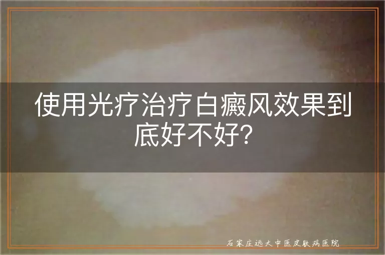 使用光疗治疗白癜风效果到底好不好？