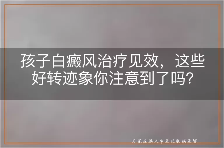 孩子白癜风治疗见效，这些好转迹象你注意到了吗？