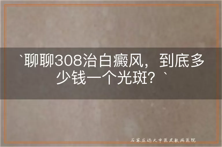 聊聊308治白癜风，到底多少钱一个光斑？