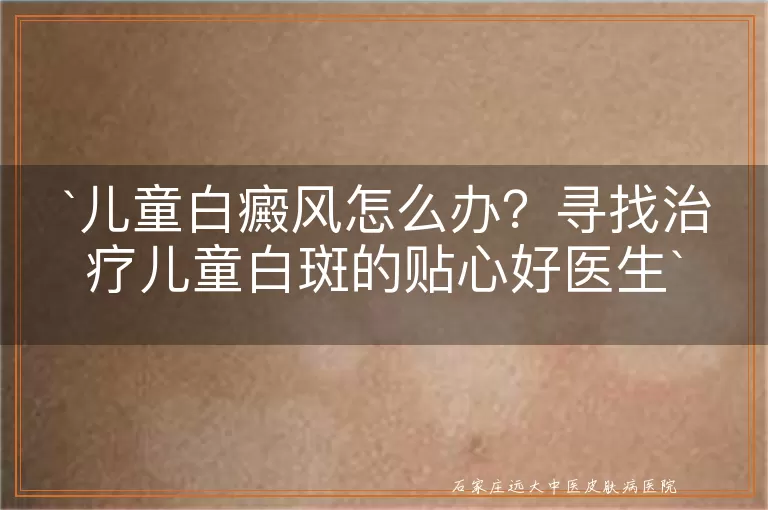 儿童白癜风怎么办？寻找治疗儿童白斑的贴心好医生