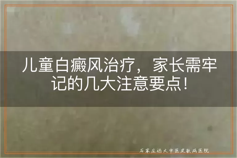 儿童白癜风治疗，家长需牢记的几大注意要点！