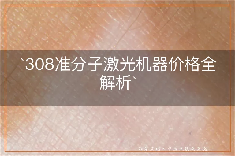 308准分子激光机器价格全解析