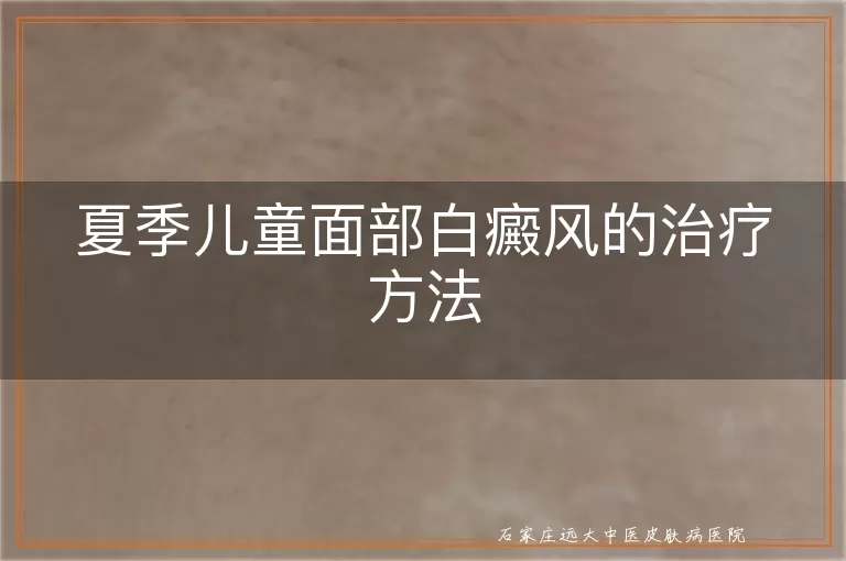 夏季儿童面部白癜风的治疗方法