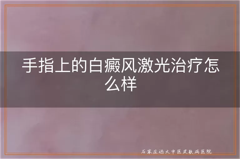 手指上的白癜风激光治疗怎么样
