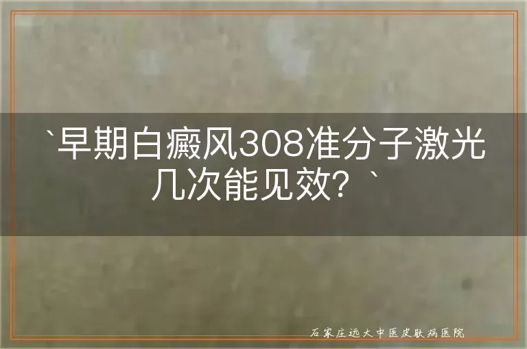 早期白癜风308准分子激光几次能见效？