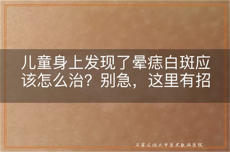 儿童身上发现了晕痣白斑应该怎么治？别急，这里有招！