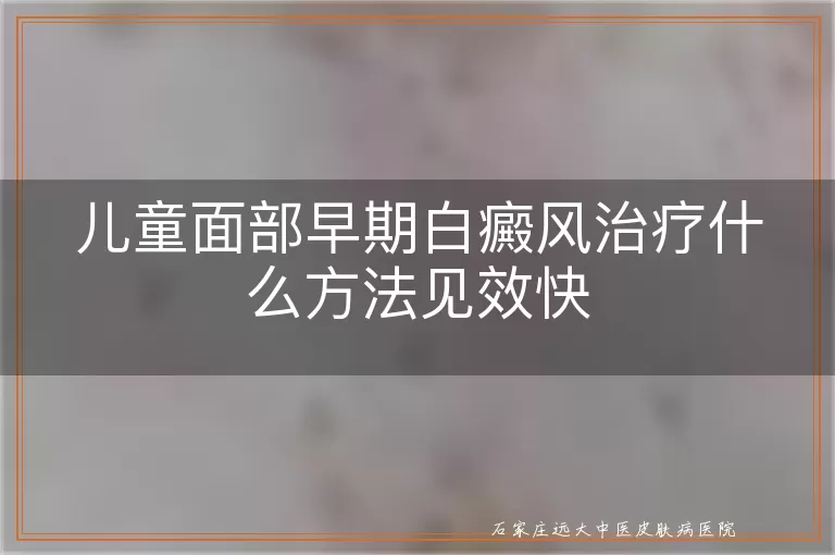 儿童面部早期白癜风治疗什么方法见效快