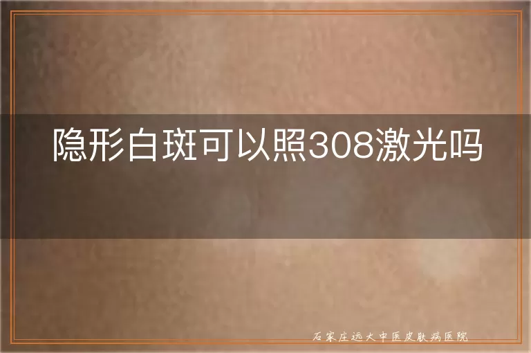 隐形白斑可以照308激光吗