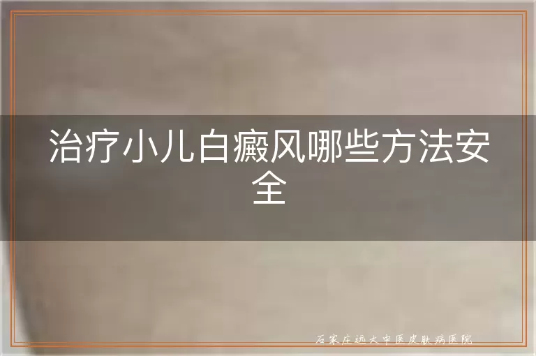 治疗小儿白癜风哪些方法安全