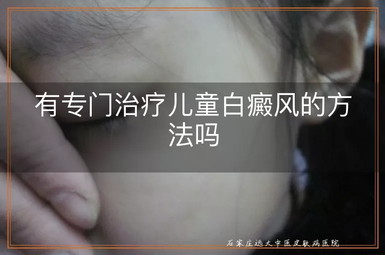 有专门治疗儿童白癜风的方法吗