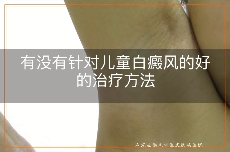 有没有针对儿童白癜风的好的治疗方法
