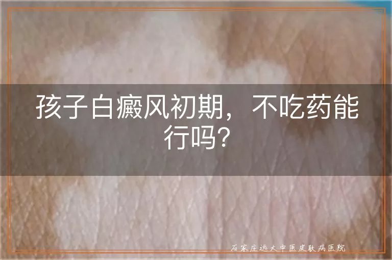 孩子白癜风初期，不吃药能行吗？
