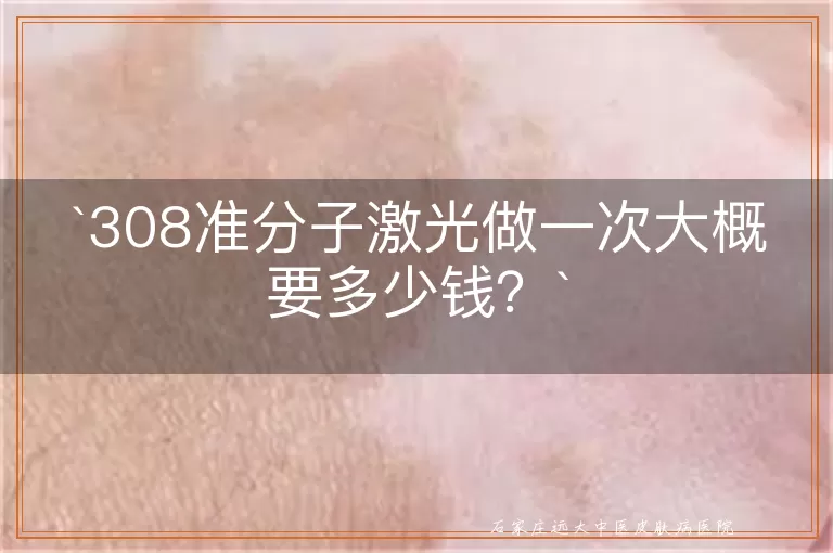 308准分子激光做一次大概要多少钱?
