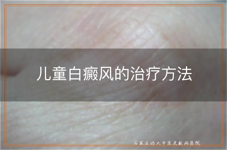 儿童白癜风的治疗方法