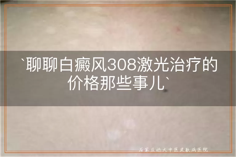 聊聊白癜风308激光治疗的价格那些事儿