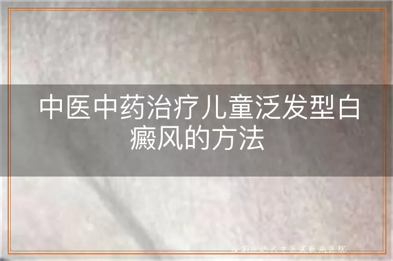 中医中药治疗儿童泛发型白癜风的方法