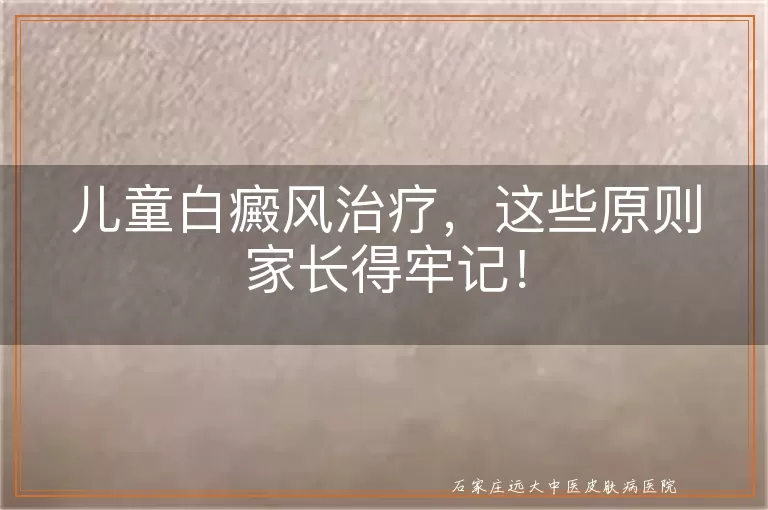 儿童白癜风治疗，这些原则家长得牢记！