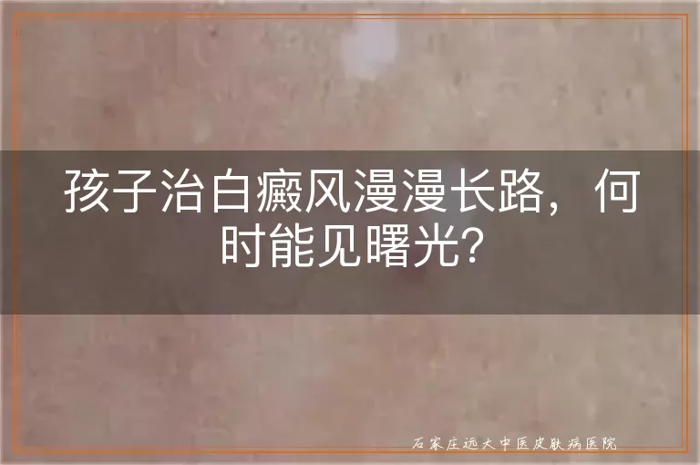 孩子治白癜风漫漫长路，何时能见曙光？