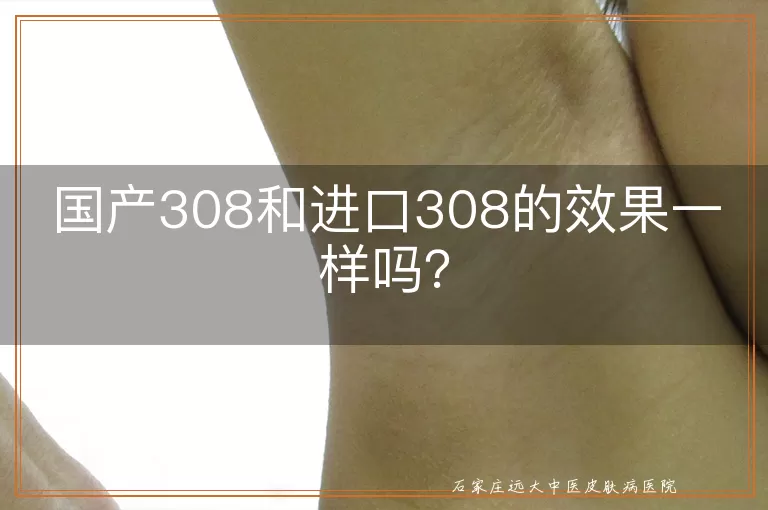 国产308和进口308的效果一样吗？