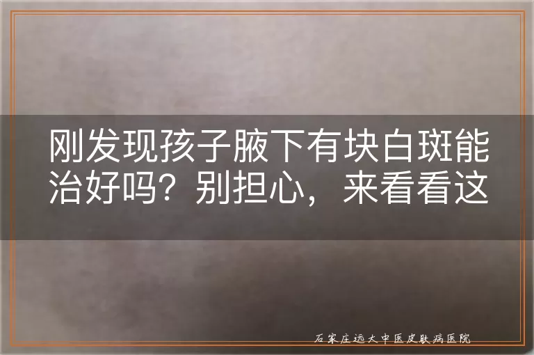 刚发现孩子腋下有块白斑能治好吗？别担心，来看看这里怎么说