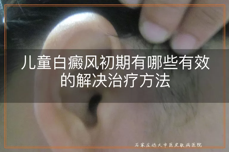 儿童白癜风初期有哪些有效的解决治疗方法