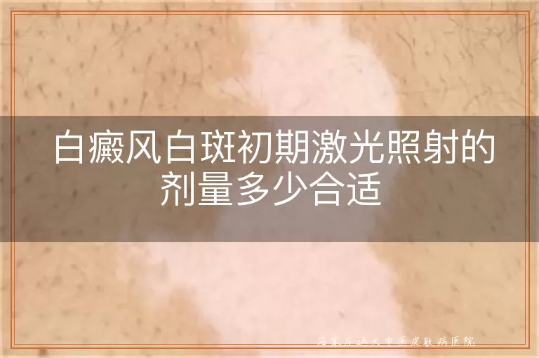 白癜风白斑初期激光照射的剂量多少合适