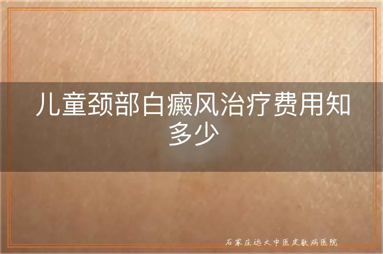 儿童颈部白癜风治疗费用知多少