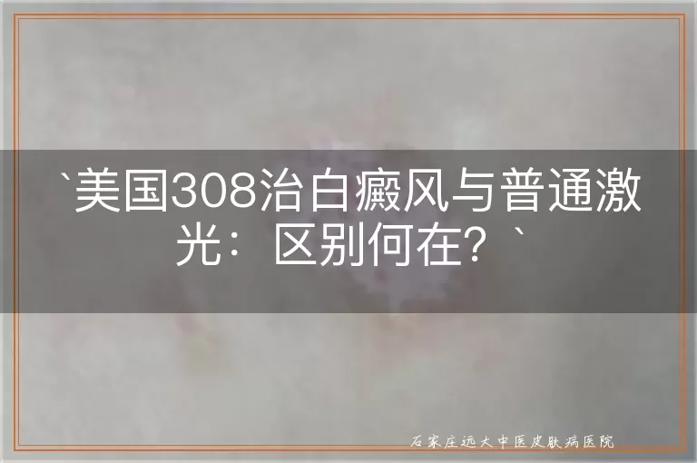 美国308治白癜风与普通激光：区别何在？