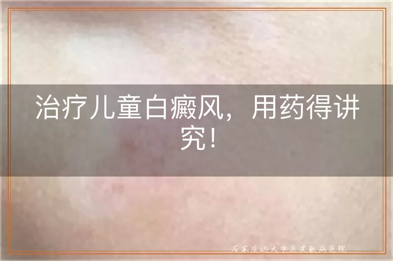 治疗儿童白癜风，用药得讲究！